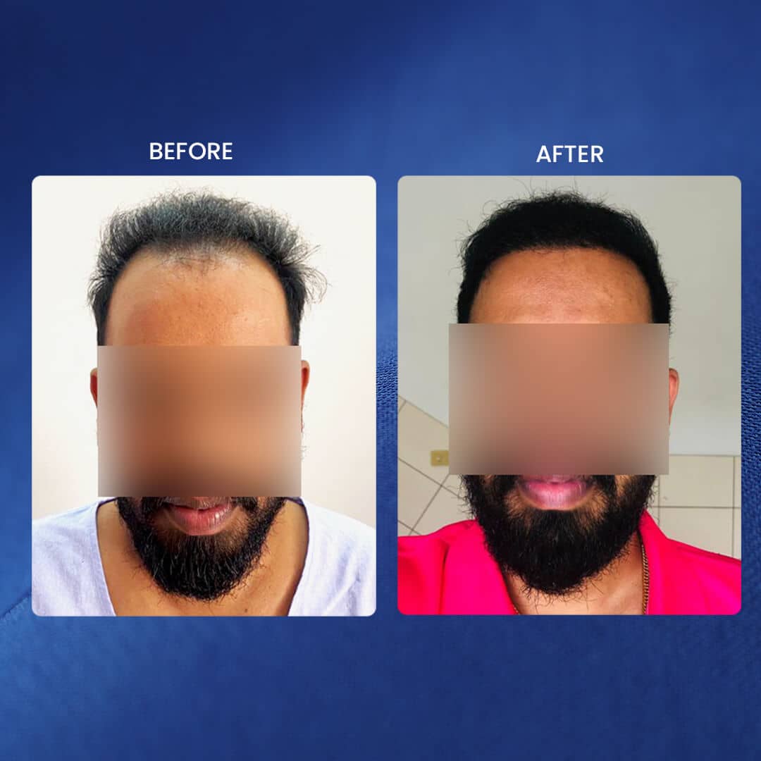 Vitality Hair Clinic - Vitality Hair Clinic